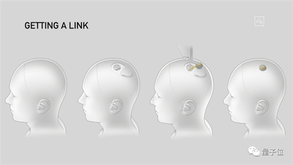 马斯克最新芯片：脑机专用 让失明人群“看见”  第8张
