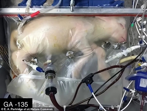 美国人造子宫有望进入人体试验！已成功孕育300多只小羊羔  第1张