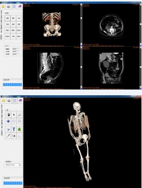 数字化放射学诊断：DDR技术助力医学影像分析与疾病诊断的革新  第2张
