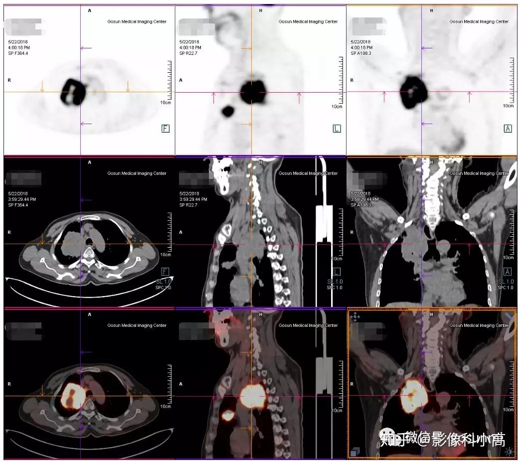 数字化放射学诊断：DDR技术助力医学影像分析与疾病诊断的革新  第3张
