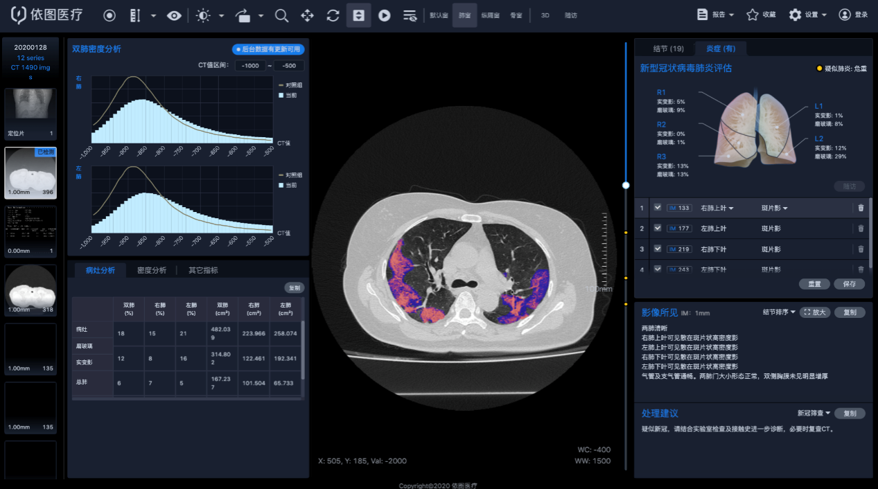 数字化放射学诊断：DDR技术助力医学影像分析与疾病诊断的革新  第4张
