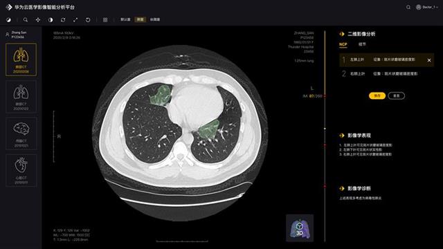 数字化放射学诊断：DDR技术助力医学影像分析与疾病诊断的革新  第6张