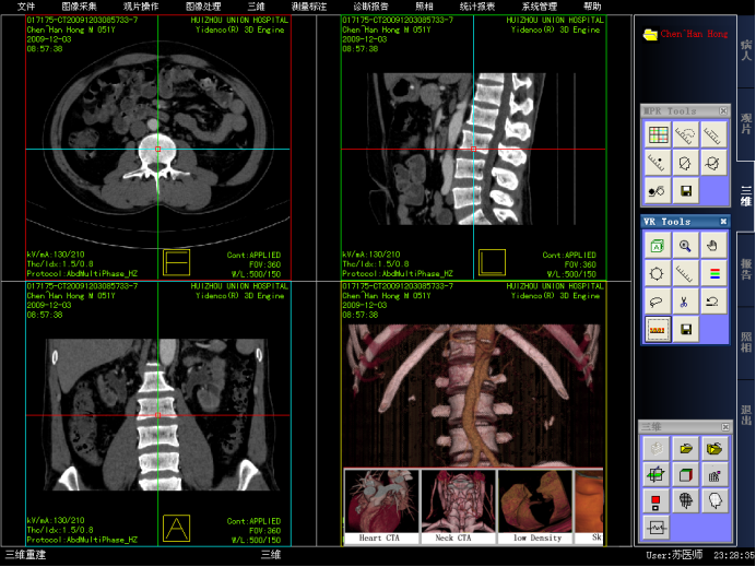 数字化放射学诊断：DDR技术助力医学影像分析与疾病诊断的革新  第8张