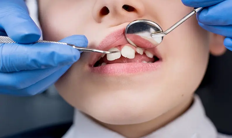 口腔DDR探针：革新口腔医学的先进技术与个性化治疗  第5张
