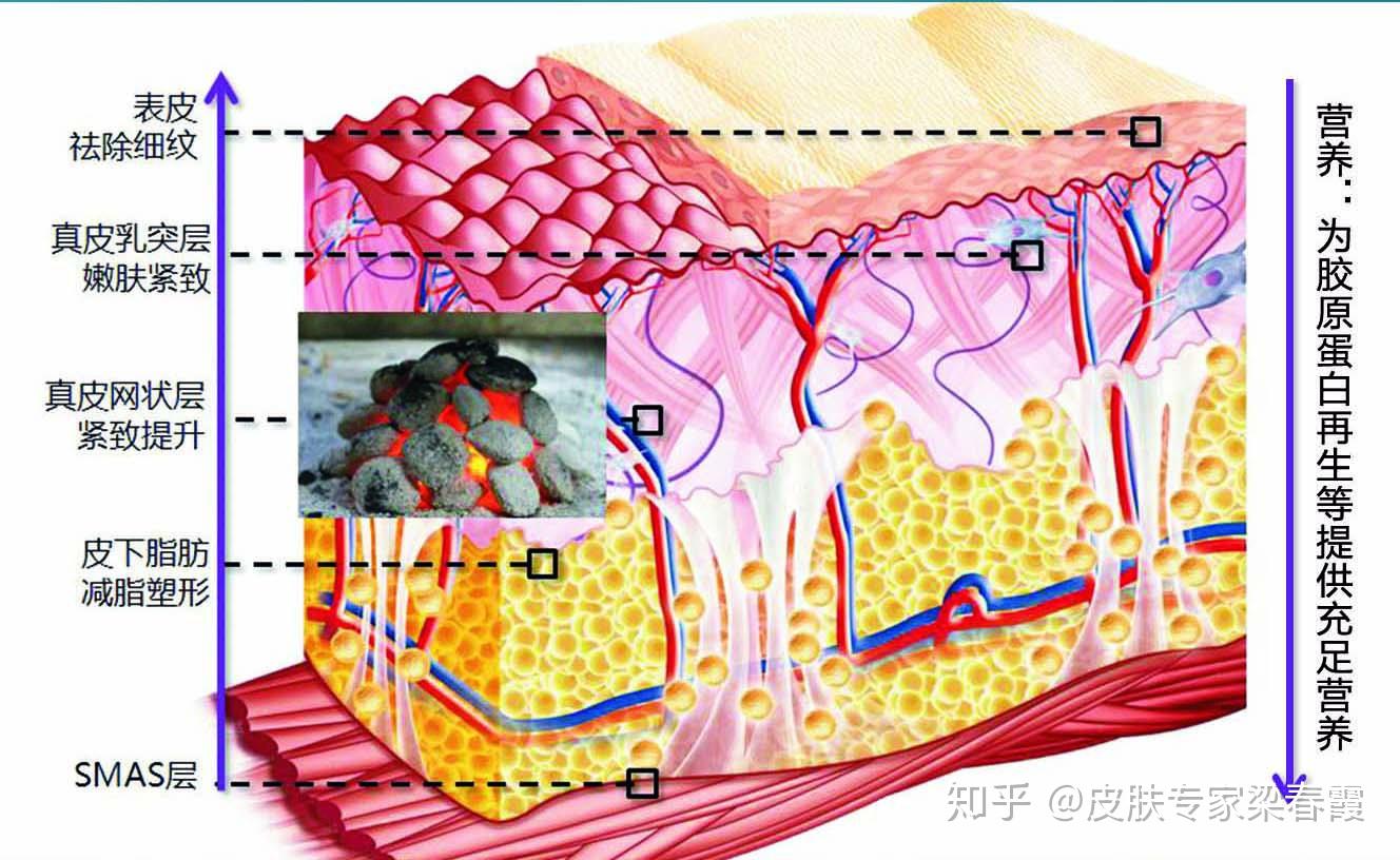 口腔DDR探针：革新口腔医学的先进技术与个性化治疗  第8张