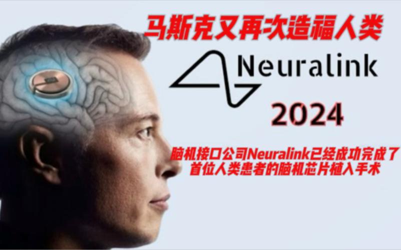 马斯克脑机接口公司Neuralink获批加拿大临床试验，招募受试者开启未来科技新纪元  第5张