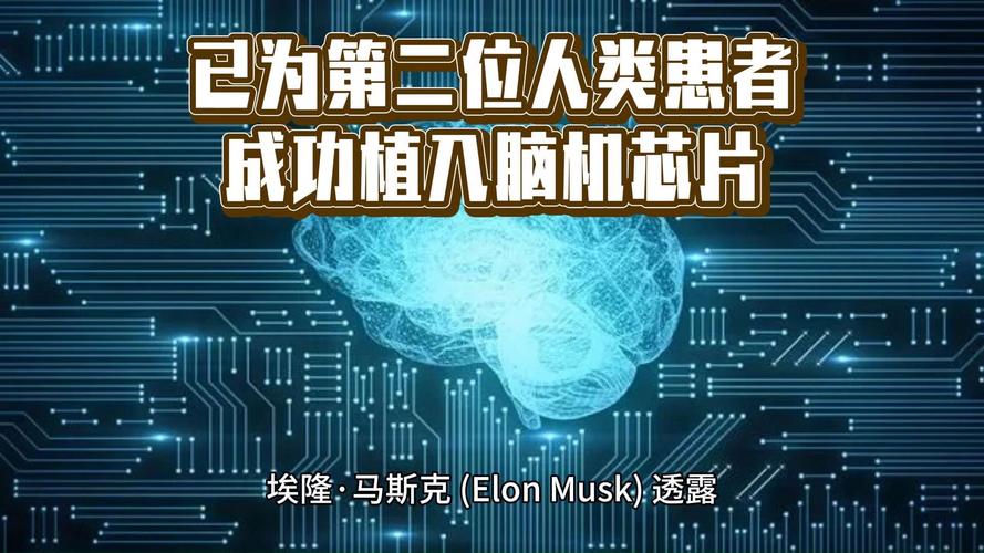 马斯克脑机接口公司Neuralink获批加拿大临床试验，招募受试者开启未来科技新纪元  第7张