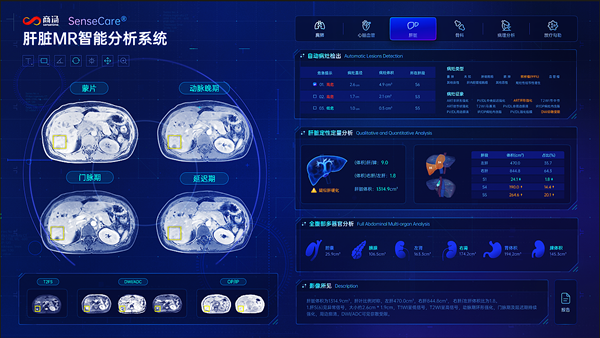 手机5g wifi 5G与WiFi，数字时代的终极对决  第1张