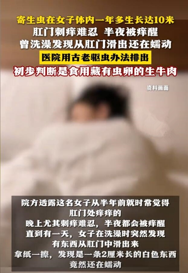 40岁女子肛门奇痒难忍，洗澡时惊现2厘米白色异物，竟是长达十米的牛带绦虫  第11张