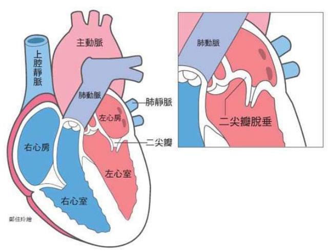 心脏超声 DDR：直观评估心脏健康的重要检查方法  第3张