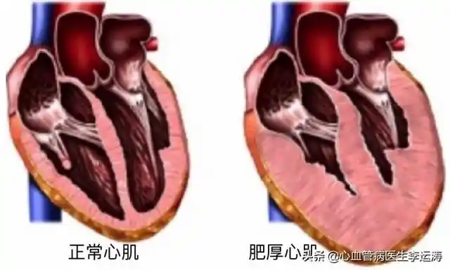 心脏超声 DDR：直观评估心脏健康的重要检查方法  第8张