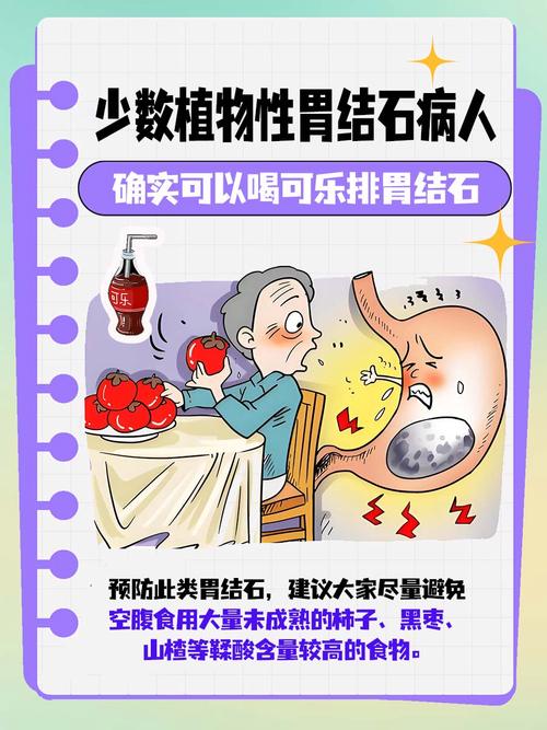 喝可乐能治胃结石？真相揭秘：大量饮用可乐的潜在风险与正确治疗方式  第4张