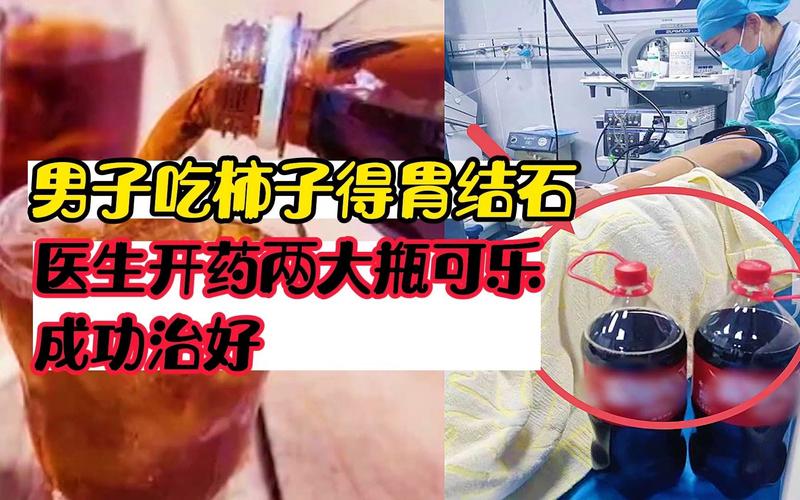 喝可乐能治胃结石？真相揭秘：大量饮用可乐的潜在风险与正确治疗方式  第10张