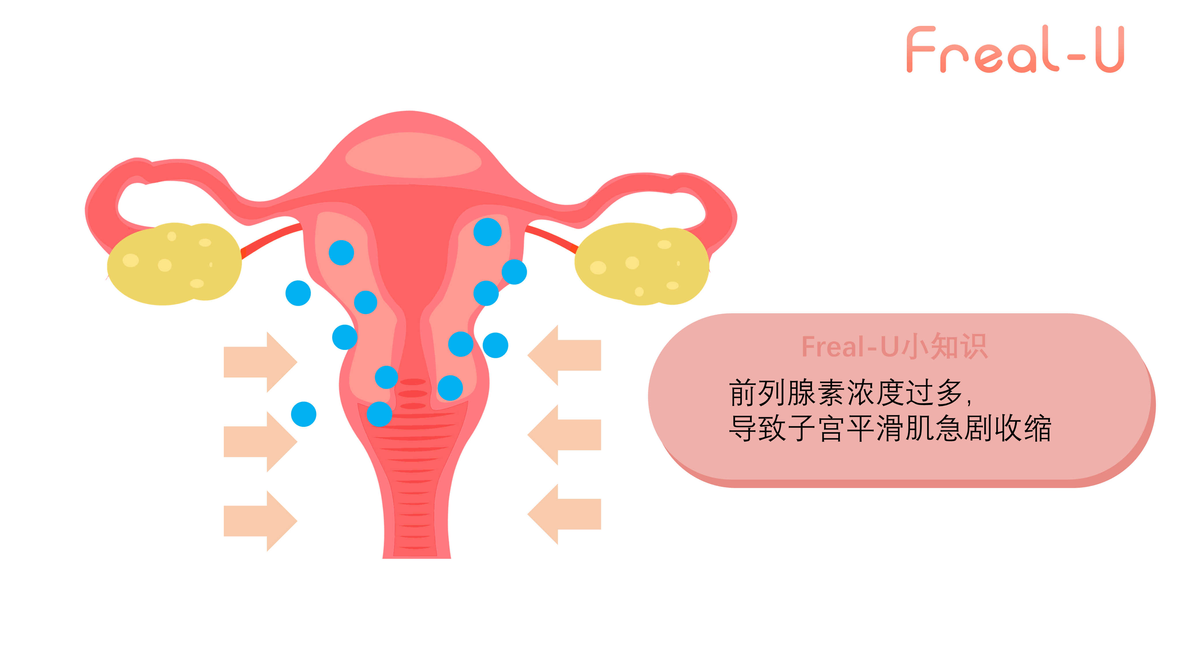 生活习惯如何影响DDR原发性不孕？探索其定义、成因、影响、预防和治疗策略  第3张