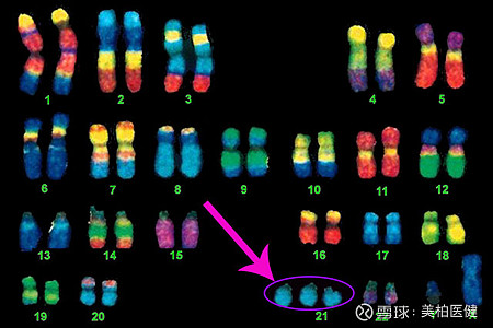 ddr婴儿 DDR 婴儿：基因编辑技术的突破与社会争议的焦点