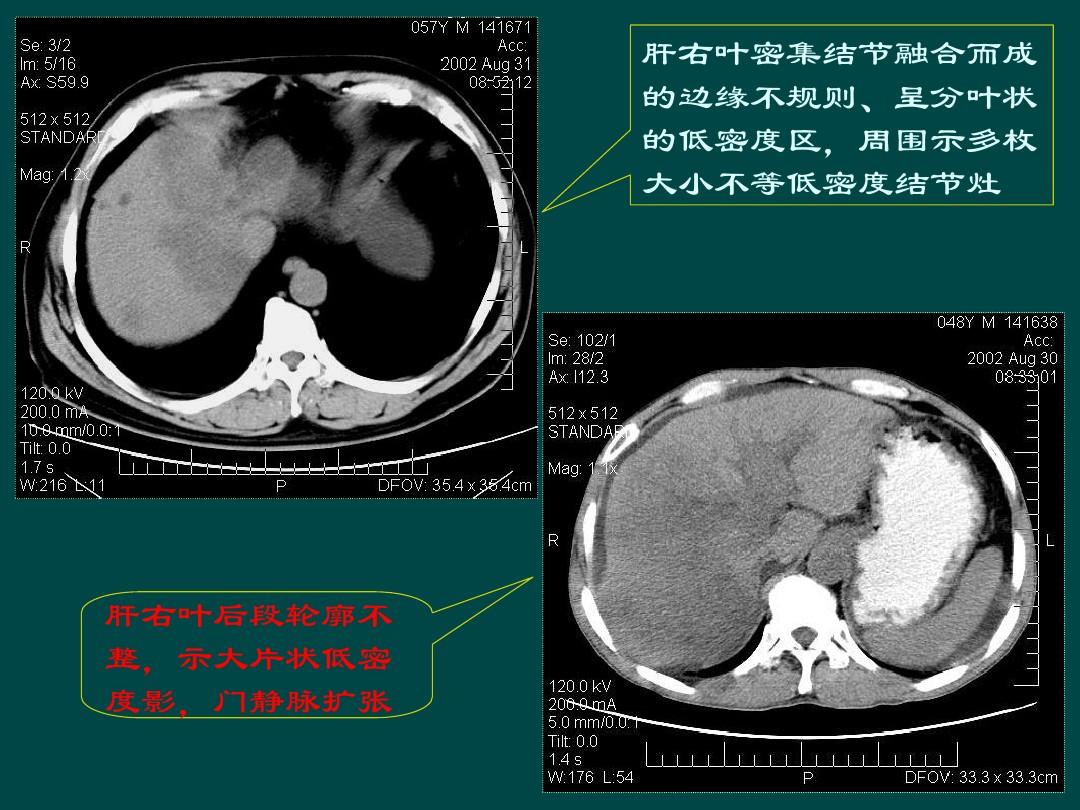 ym ddr 深入了解 YMDDR：起源、发展与全球影响力  第7张