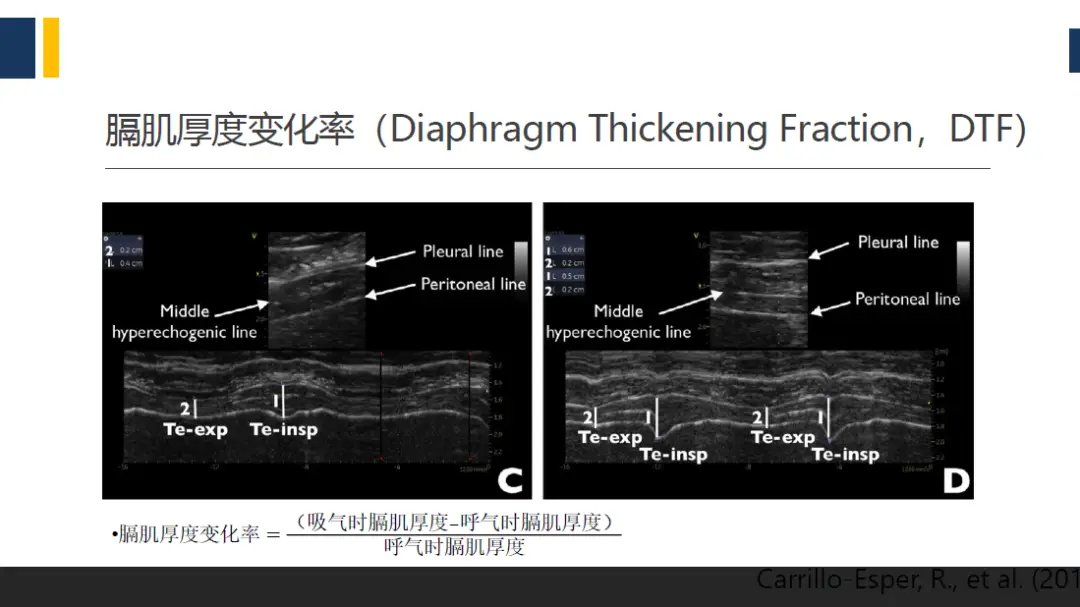 腰椎DDR影像图解析与康复建议：专业医师的综合指南  第4张