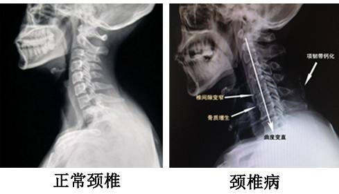 ddr颈椎 DDR：不仅仅是游戏，更是缓解颈椎不适的希望所在  第2张