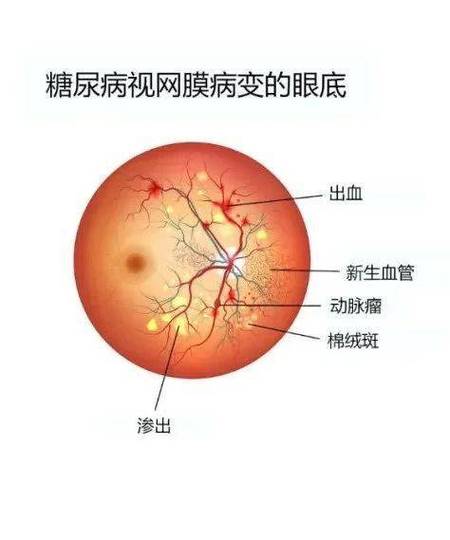 惊！27岁白领用网红眼药水后视力骤降至0.1，医生揭秘背后真相  第8张