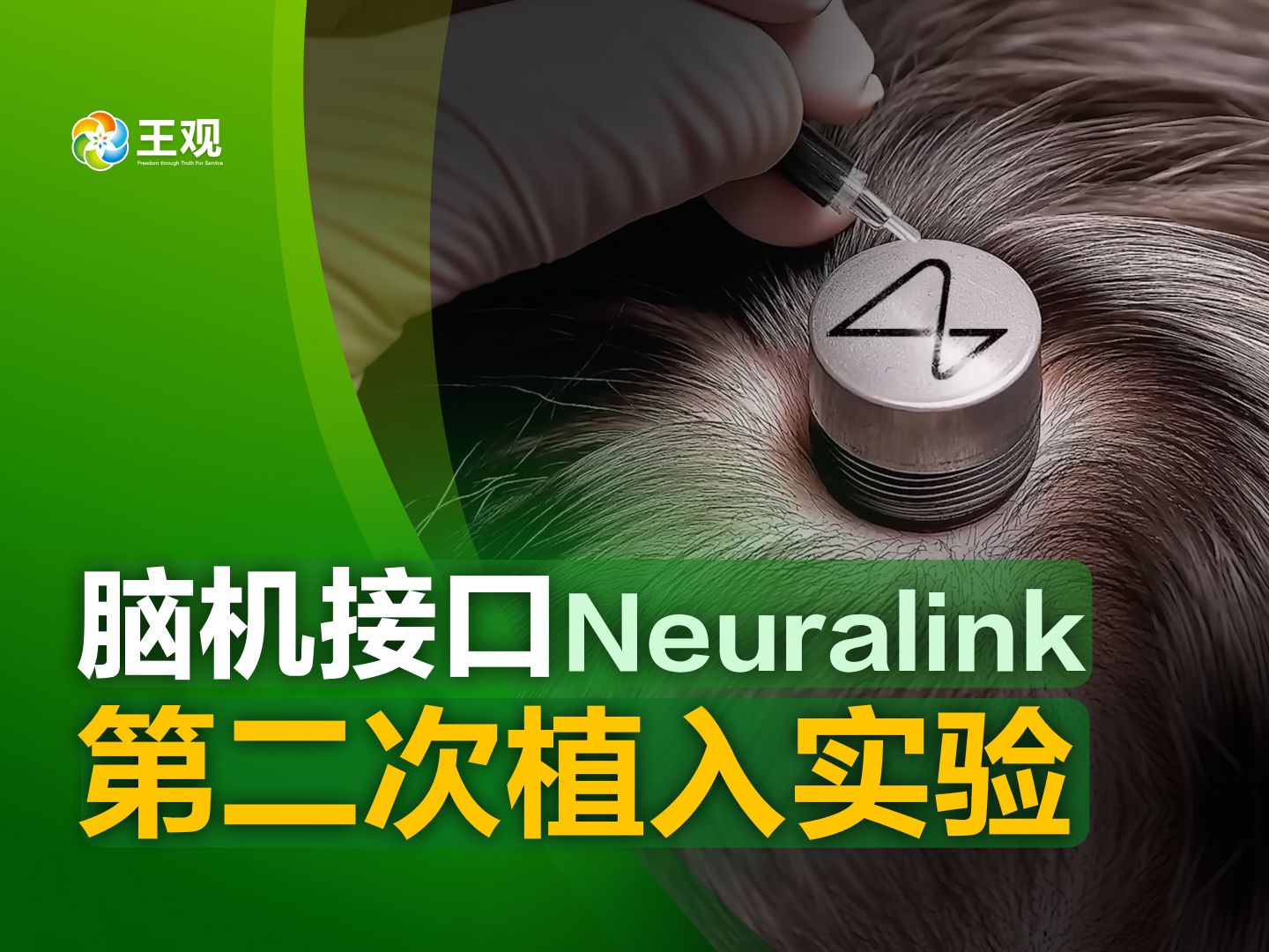 全国第三例脑机接口产品临床试验植入手术成功！上海第一例  第7张