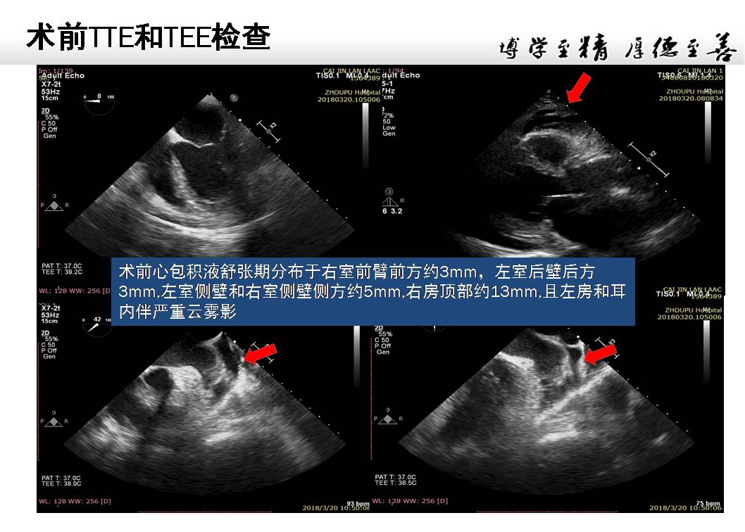 5G网络：革命性技术还是健康隐患？  第2张