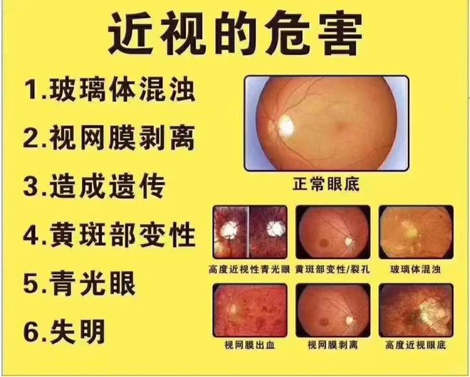 gt4g显卡 GT4G显卡技术揭秘：性能革新与光线追踪特性探秘  第7张