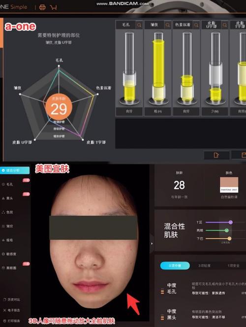 揭秘美图宜肤AI黑科技：如何精准识别皮肤问题，告别误判困扰？  第9张