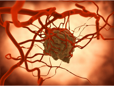 非小细胞肺癌DDR患者的个体化治疗与免疫疗法研究现状  第3张