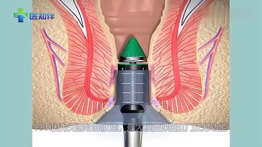 音箱线缆连接问题大揭秘：种类选择与适配难题全解析  第8张