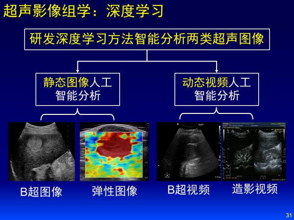 探秘超声DDR：医学影像新利器，洞察人体深层奥秘  第5张