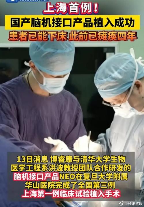 脑机接口革命：2027年上海率先实现临床应用，瘫痪患者生活质量将迎来巨大改善  第9张