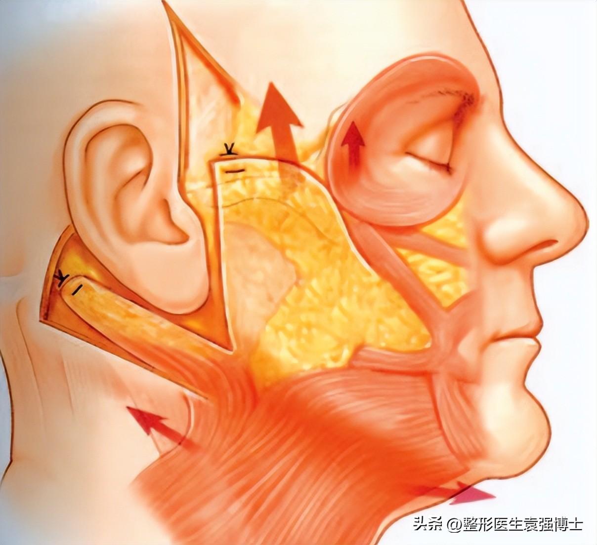 揭秘功放机与音箱接线的奥秘，让音乐更动人  第6张