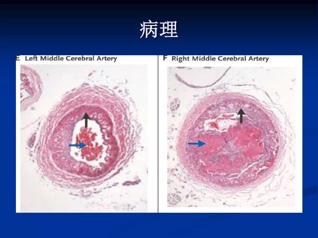 揭开 DDR4 内存的神秘面纱：电脑记忆中枢的秘密  第8张