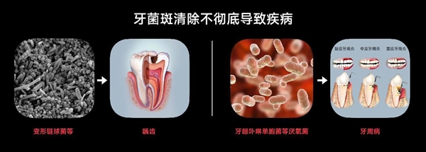 八年研发投入，全球销售覆盖！欧可林AirPump A10氧气啵啵冲牙器引领口腔健康新革命  第17张