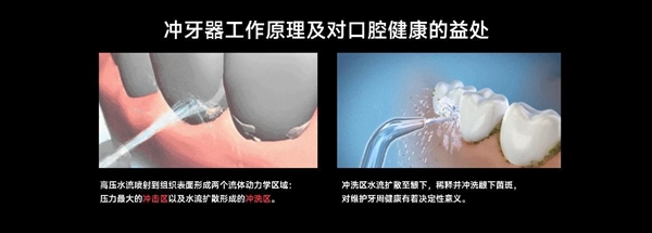 八年研发投入，全球销售覆盖！欧可林AirPump A10氧气啵啵冲牙器引领口腔健康新革命  第21张