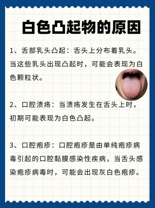 口干舌燥？别慌！揭秘身体发出的健康信号，你真的了解吗？  第8张