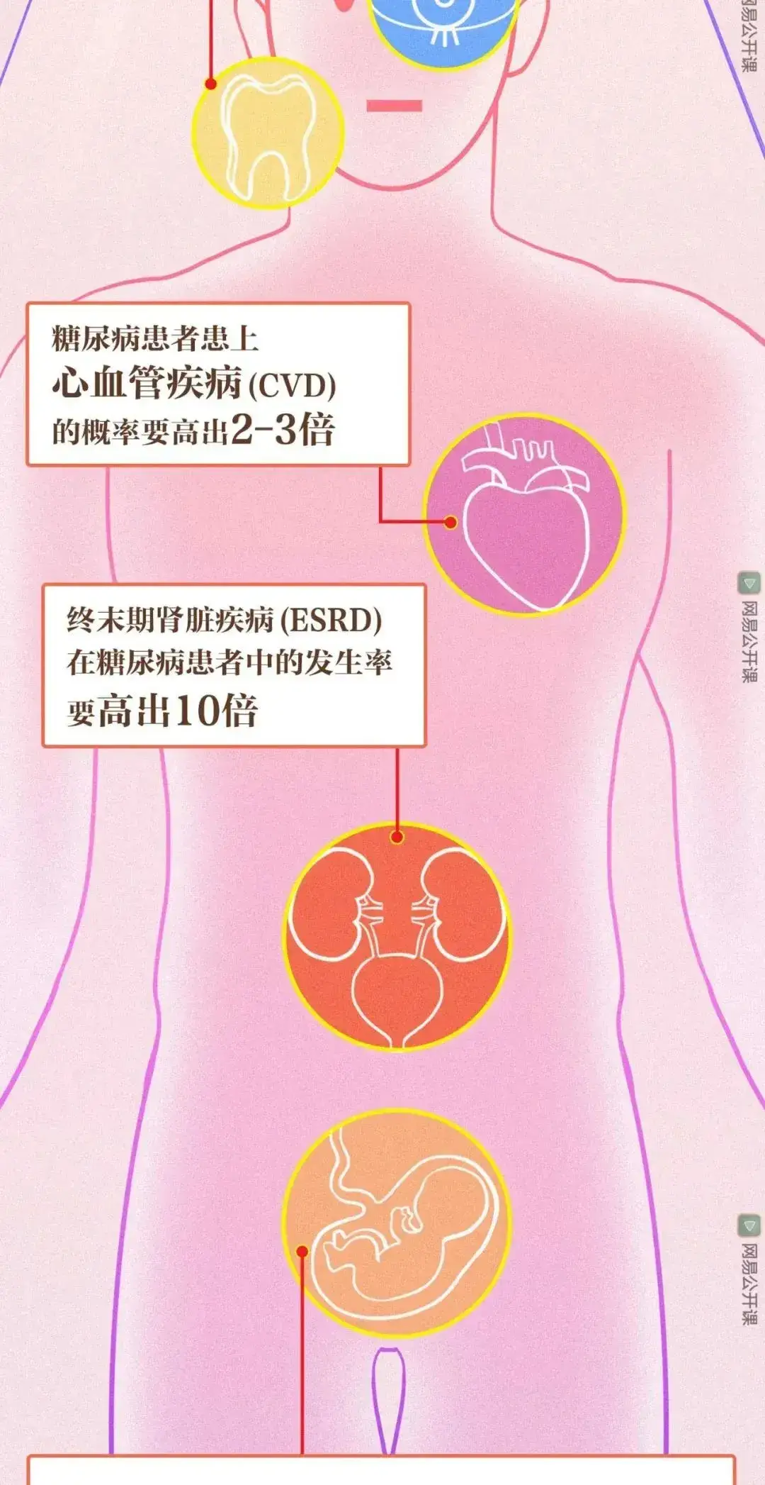 安卓系统更新指南：升级的必要性、潜在风险与检查方法  第3张