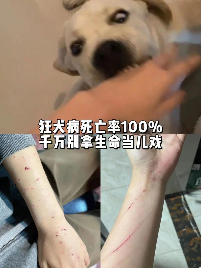 长沙县狂犬病死亡病例引发关注，家养狗成主要传播源，你家宠物安全吗？  第10张