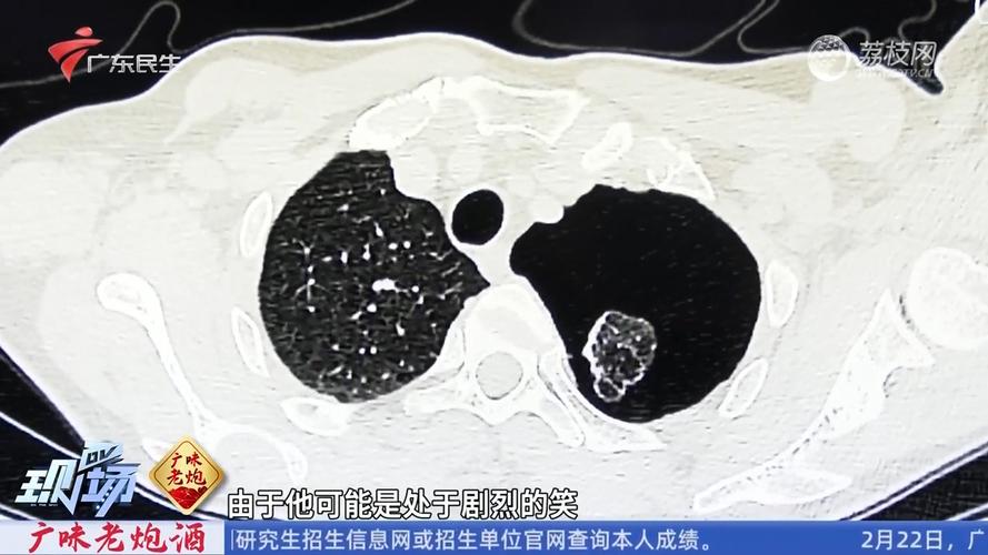 瘦高青少年为何更易‘爆肺’？揭秘气胸的致命真相  第2张