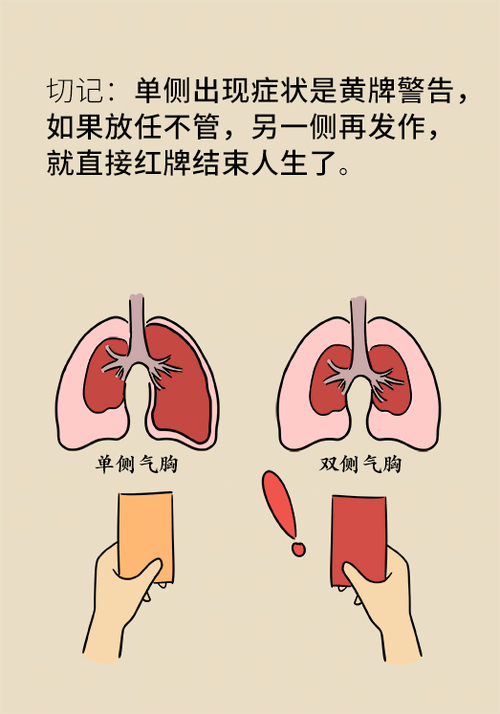 瘦高青少年为何更易‘爆肺’？揭秘气胸的致命真相  第4张