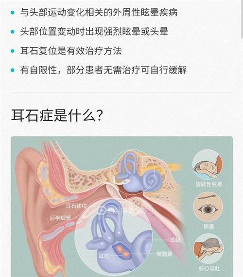 熬夜打麻将竟让她患上耳石症！你还敢继续熬夜吗？  第8张