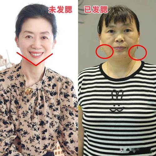 为什么年纪越大越容易发胖？揭秘中年发福的真相  第2张