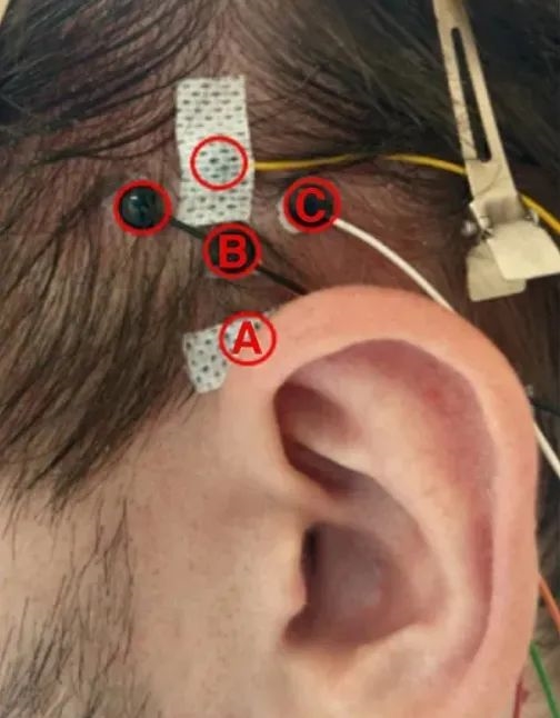 动物能转耳朵聚焦声音，人类为啥不能？  第5张