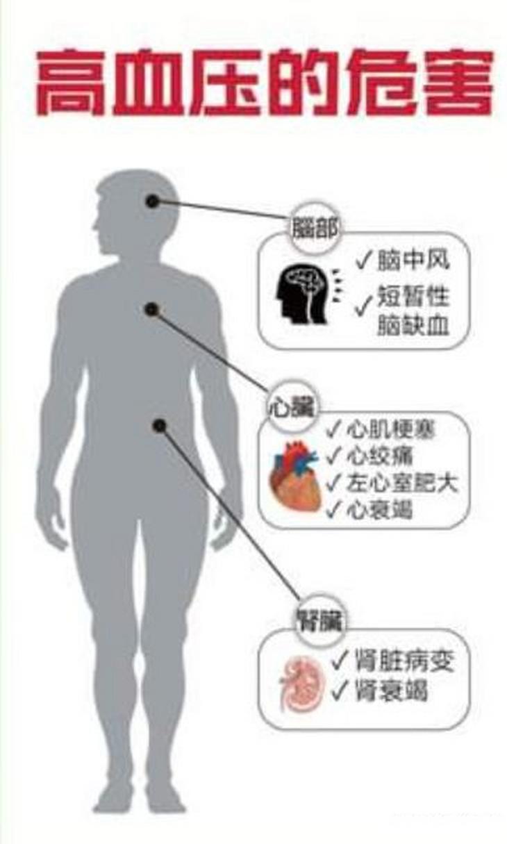 高血压真的只是小问题吗？每28秒就有一人因脑卒中离世  第3张