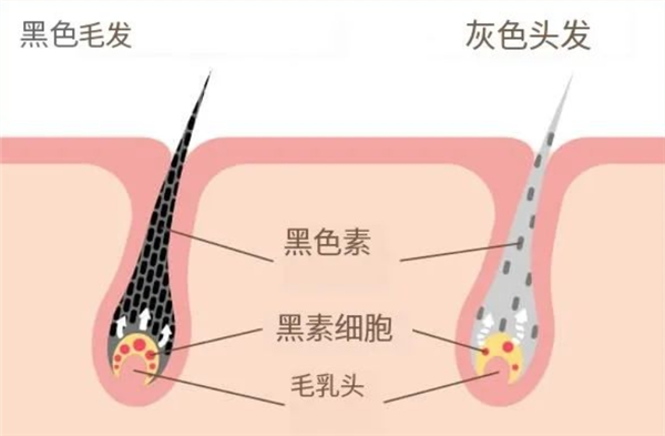 头发变白后真的能再黑回来吗？揭秘头发颜色的惊人真相