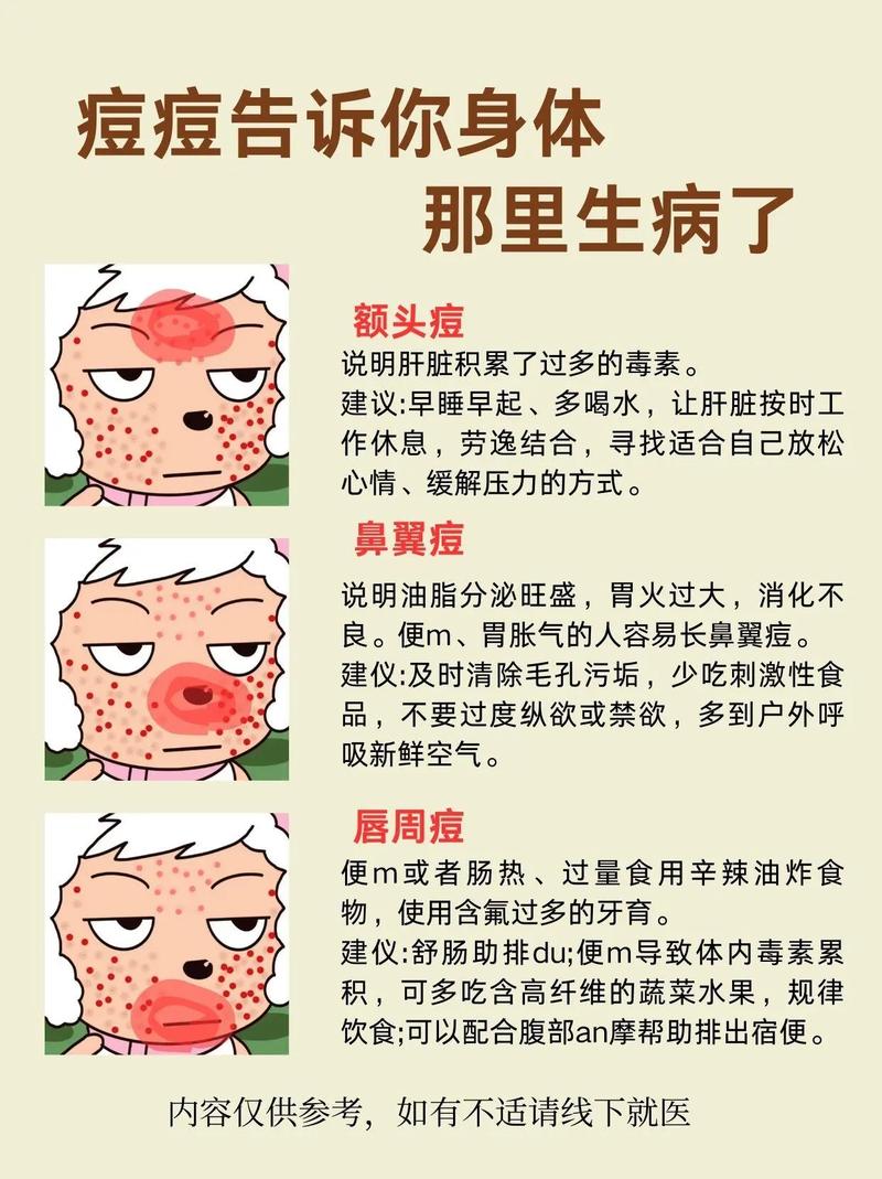 挤痘痘真的能解决问题吗？72%的人因此出现并发症  第13张