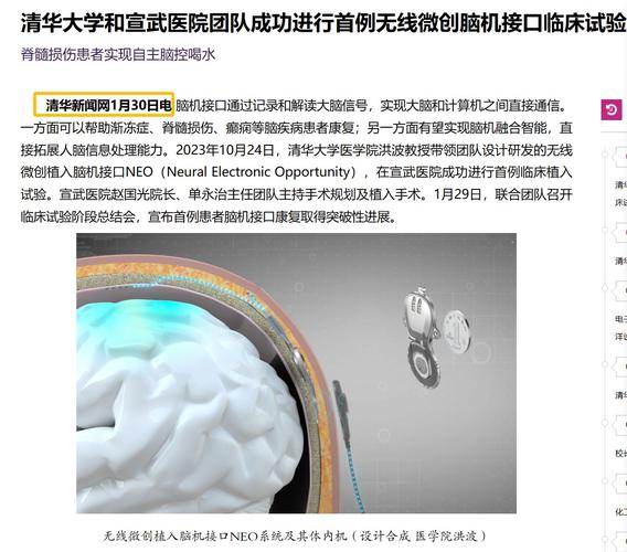 马斯克揭秘Neuralink新进展：2025年将植入20-30例患者，脑机接口技术将如何改变人类未来？  第3张