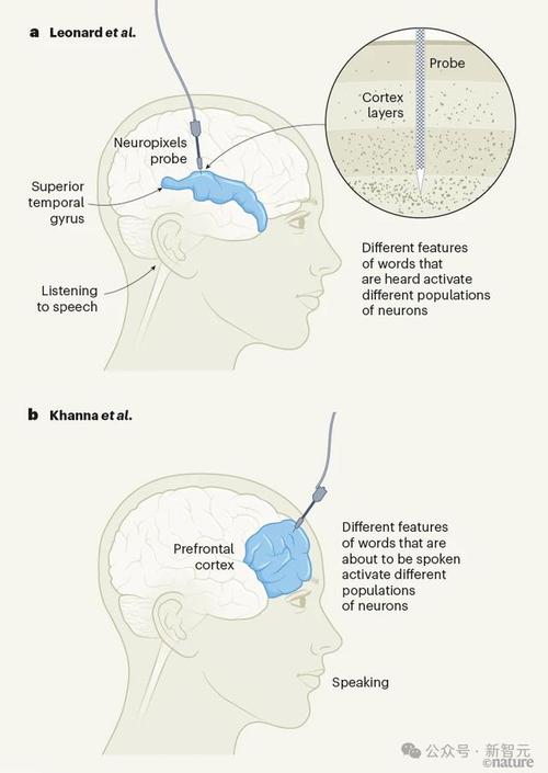 马斯克揭秘Neuralink新进展：2025年将植入20-30例患者，脑机接口技术将如何改变人类未来？  第9张