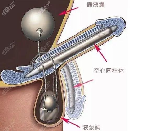 3D打印仿生阴茎海绵体问世！未来能否彻底解决男性功能障碍？  第2张