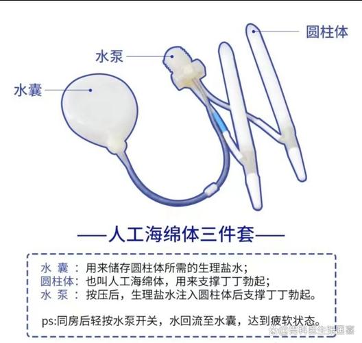 3D打印仿生阴茎海绵体问世！未来能否彻底解决男性功能障碍？  第4张